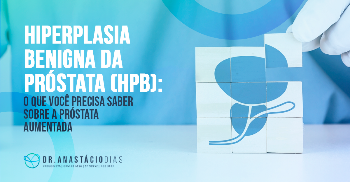 Hiperplasia benigna da próstata (HPB): o que você precisa saber sobre a próstata aumentada